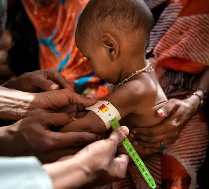 Comprendre... la malnutrition